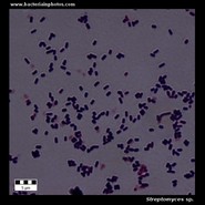 streptomyces microscopy